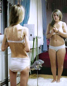 anoreksiya.jpg