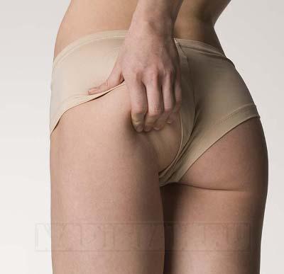 cellulite400.jpg